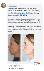 Double chin lifting mask by Riverwoods
