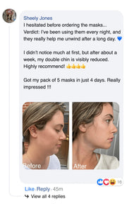 Double chin lifting mask by Riverwoods