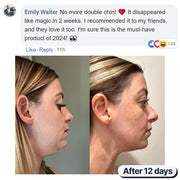 Double chin lifting mask by Riverwoods
