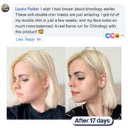 Double chin lifting mask by Riverwoods