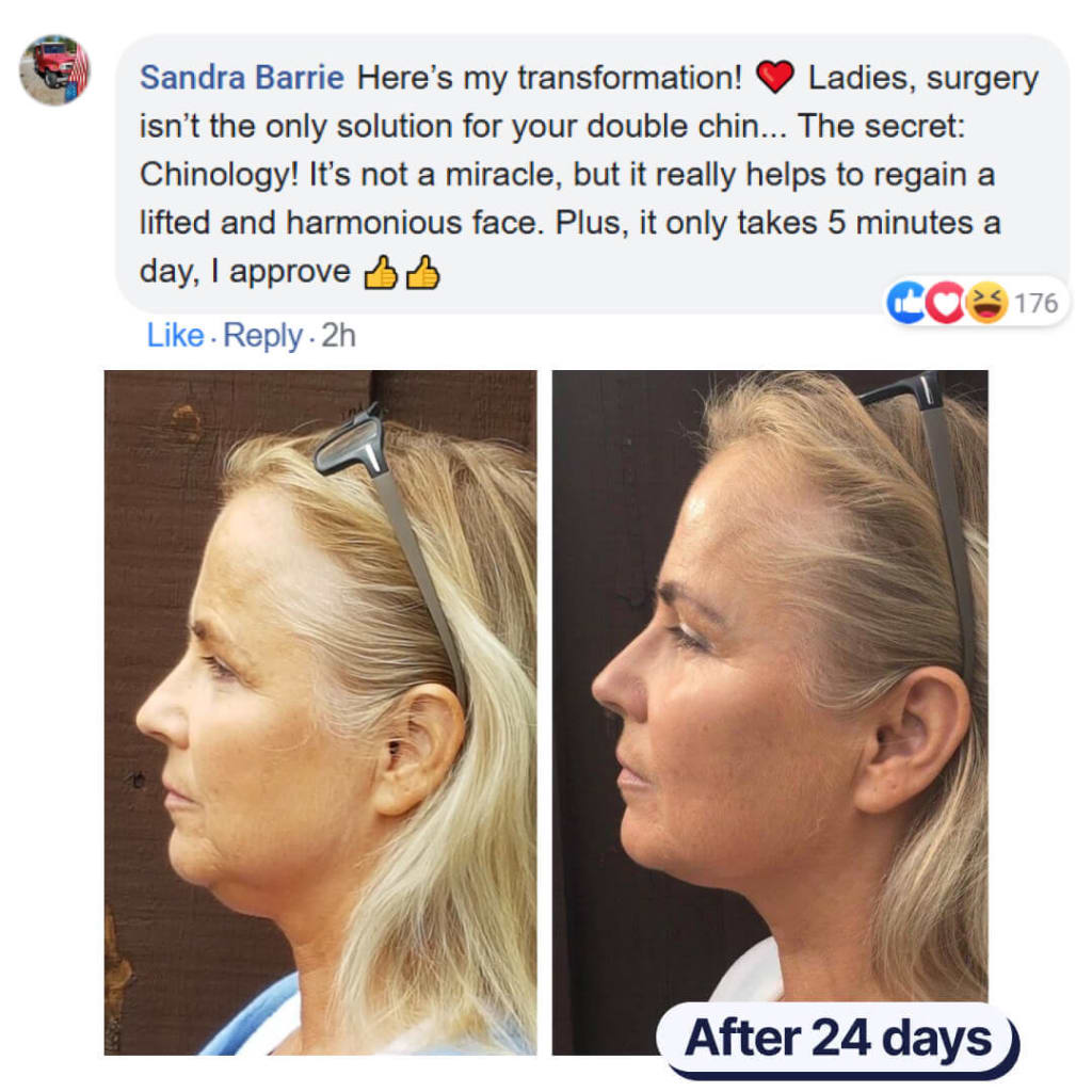 Double chin lifting mask by Riverwoods
