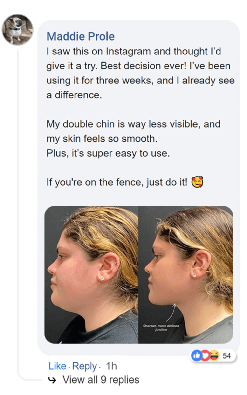 Double chin lifting mask by Riverwoods