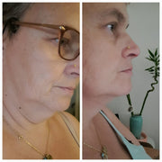 Double chin lifting mask by Riverwoods