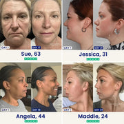 Double chin lifting mask by Riverwoods